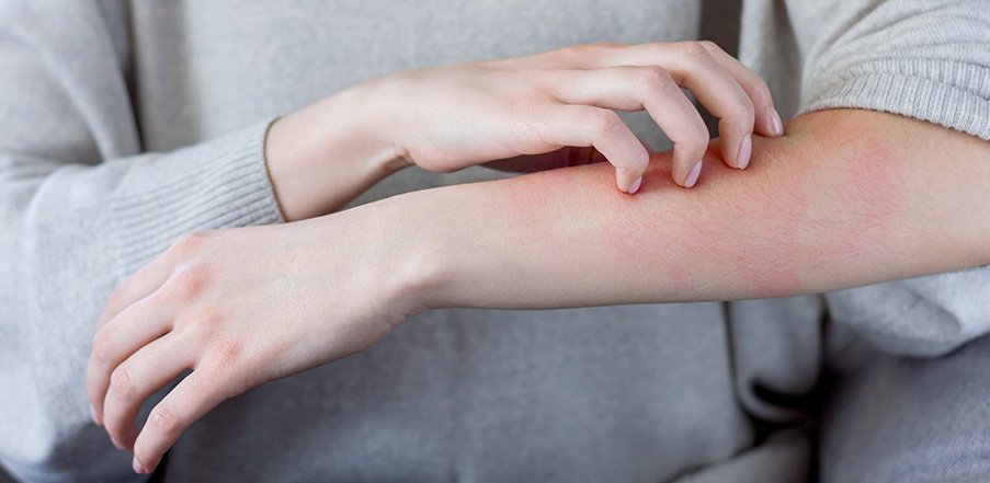 Dermatologi Non Infeksi 